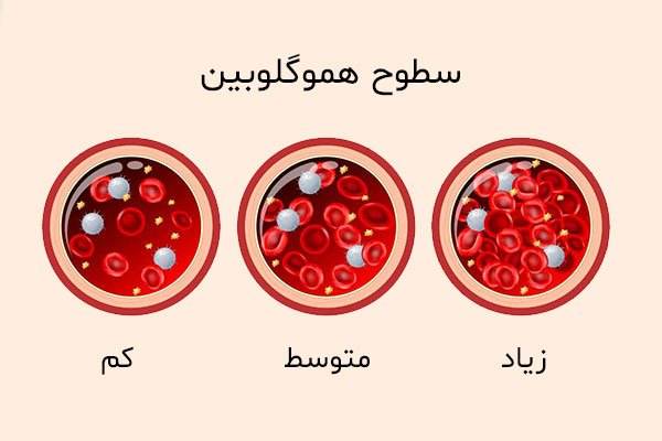 هموگلوبین (hb) چیست و مقدار نرمال آن در خون چقدر است؟